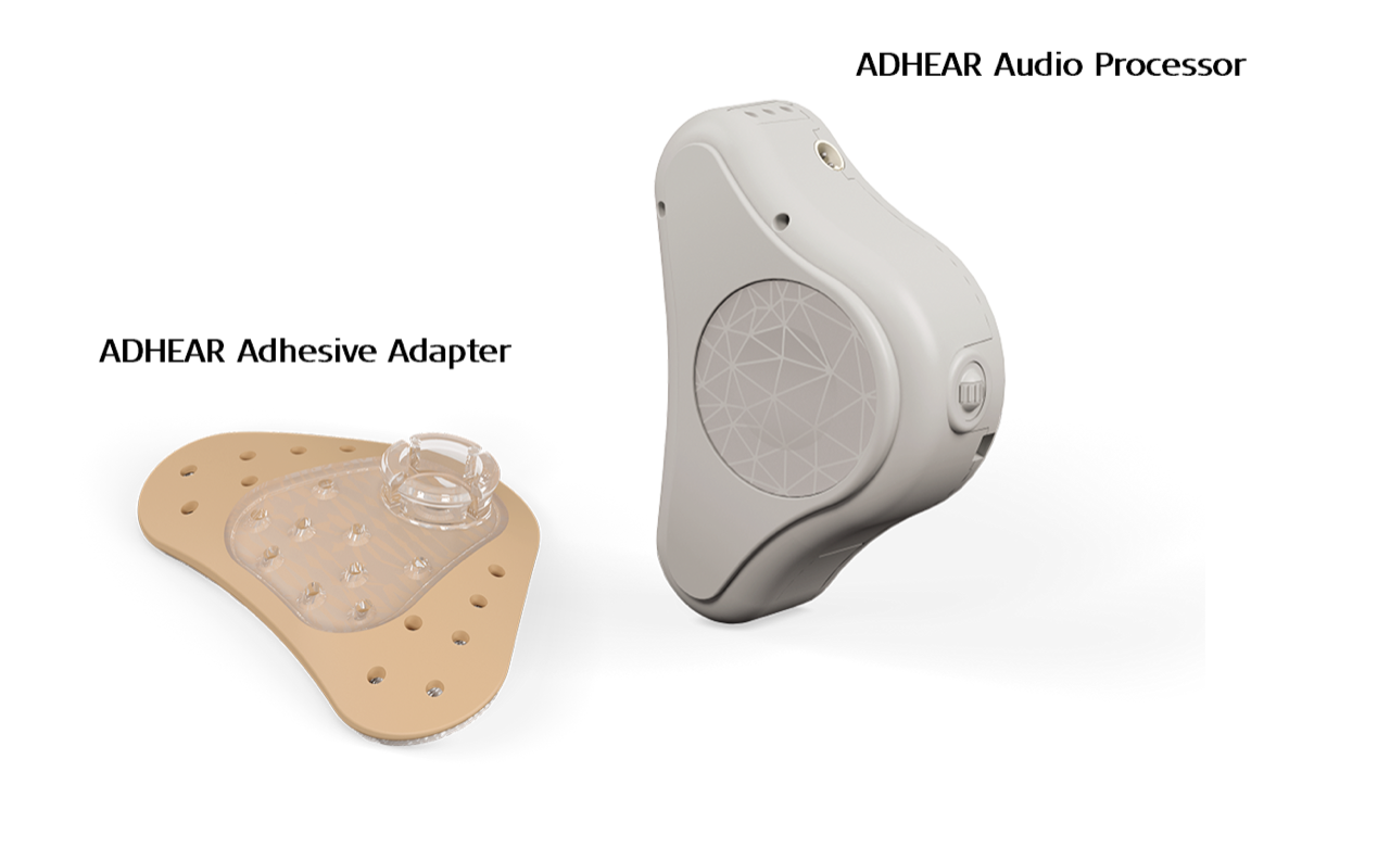 Glue Ear Guide MESHGuides
